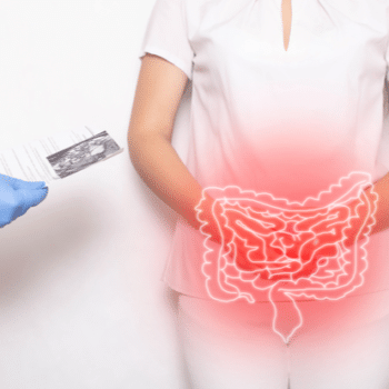 Bowel-inflammation-and-disease-abdominal-pain