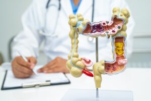 Model of digestive tract in front of a doctor on a table.